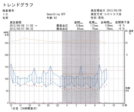 トレンドグラフ